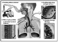 Diagram of Particulate Matter Effects